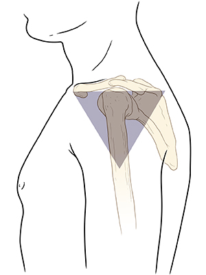 Side view of person's arm showing shaded triangle as injection site area below bone at top of upper arm.