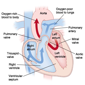 Cross section of heart showing normal blood circulation. Arrows on right side of heart show oxygen-poor blood pumping to lungs. Arrows on left side of heart show oxygen-rich blood pumped to body.